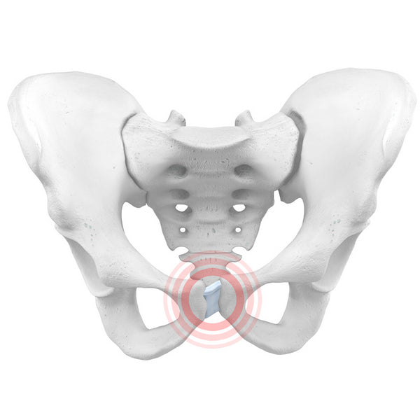 Symphysis Pubis Dysfunction - Pubic Bone Pain