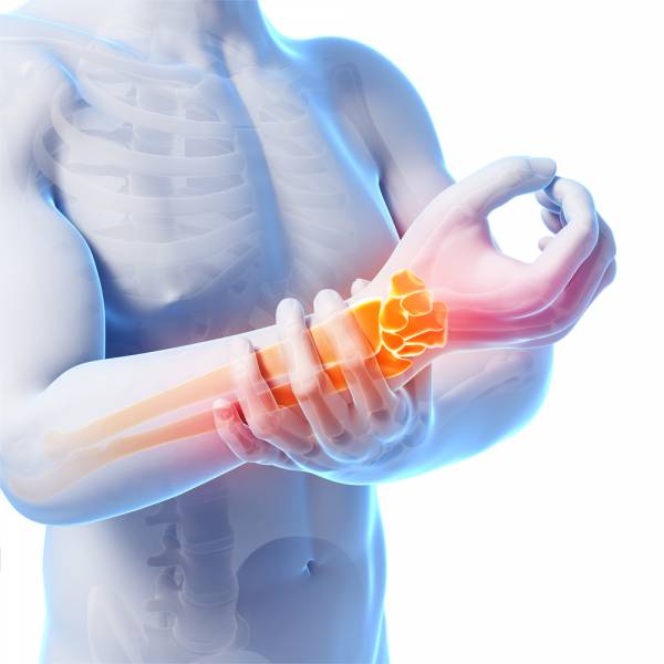 Wringer Injury Wrist Injury in Sports: Overview And Management